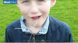 Ирландский папаша вырвал сыну молочный зуб с помощью дрона